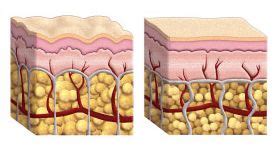Velashape Scottsdale .